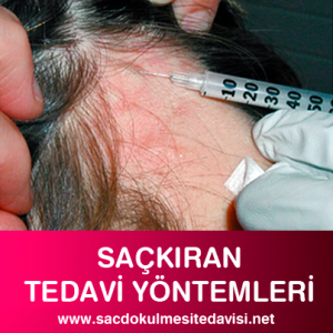 Saçkıran Tedavi