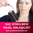 Saç Dökülmesi Anlama