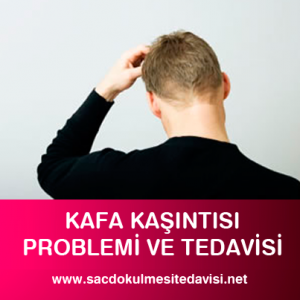 Kafa Kaşıntısı