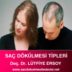 Saç Dökülmesi Tipleri