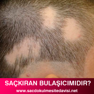 Saçkıran Bulaşıcımı